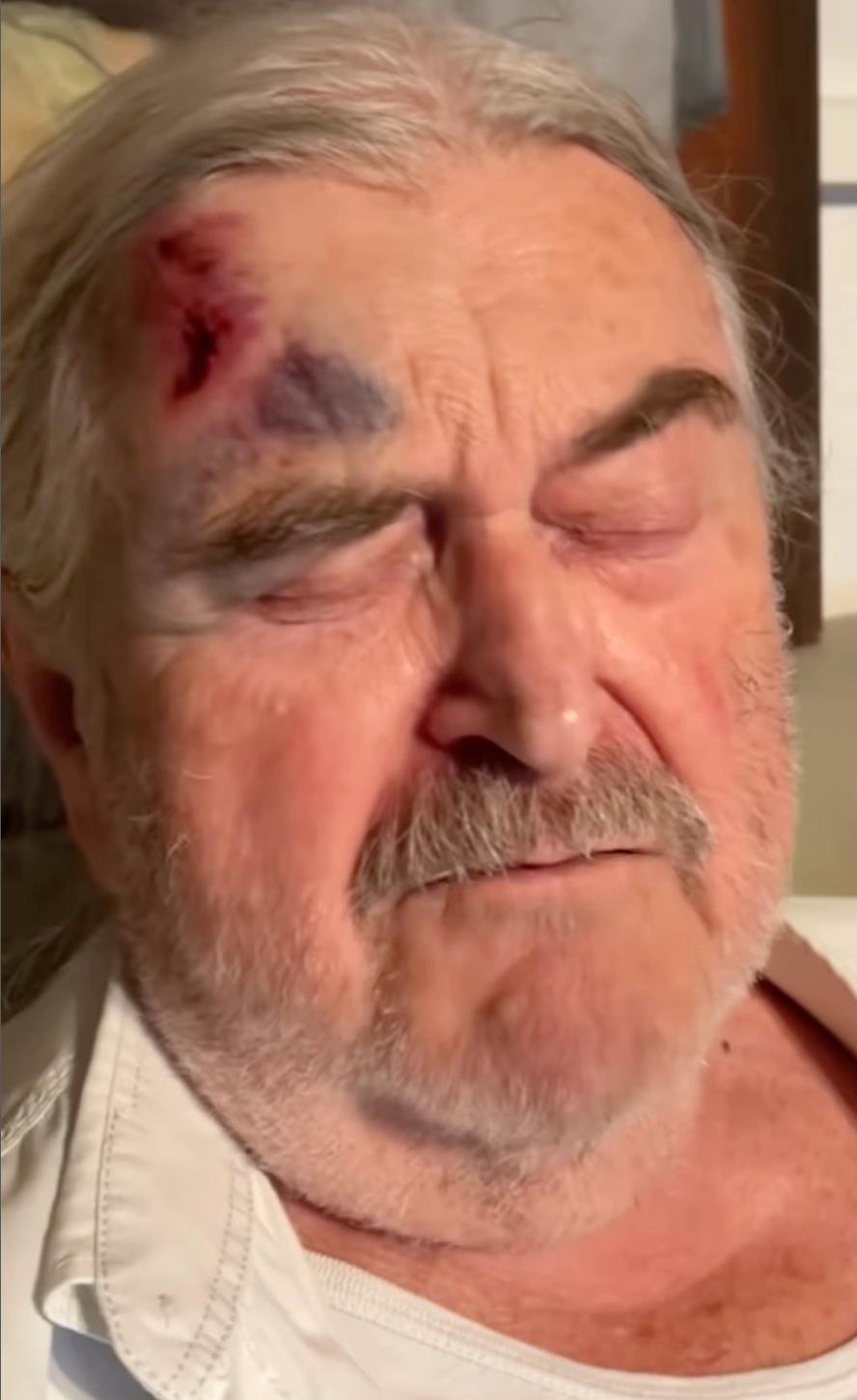 Co stojí za zkrvaveným Ringo Čechem? Záhadný monokl a příběh, který nedává smysl