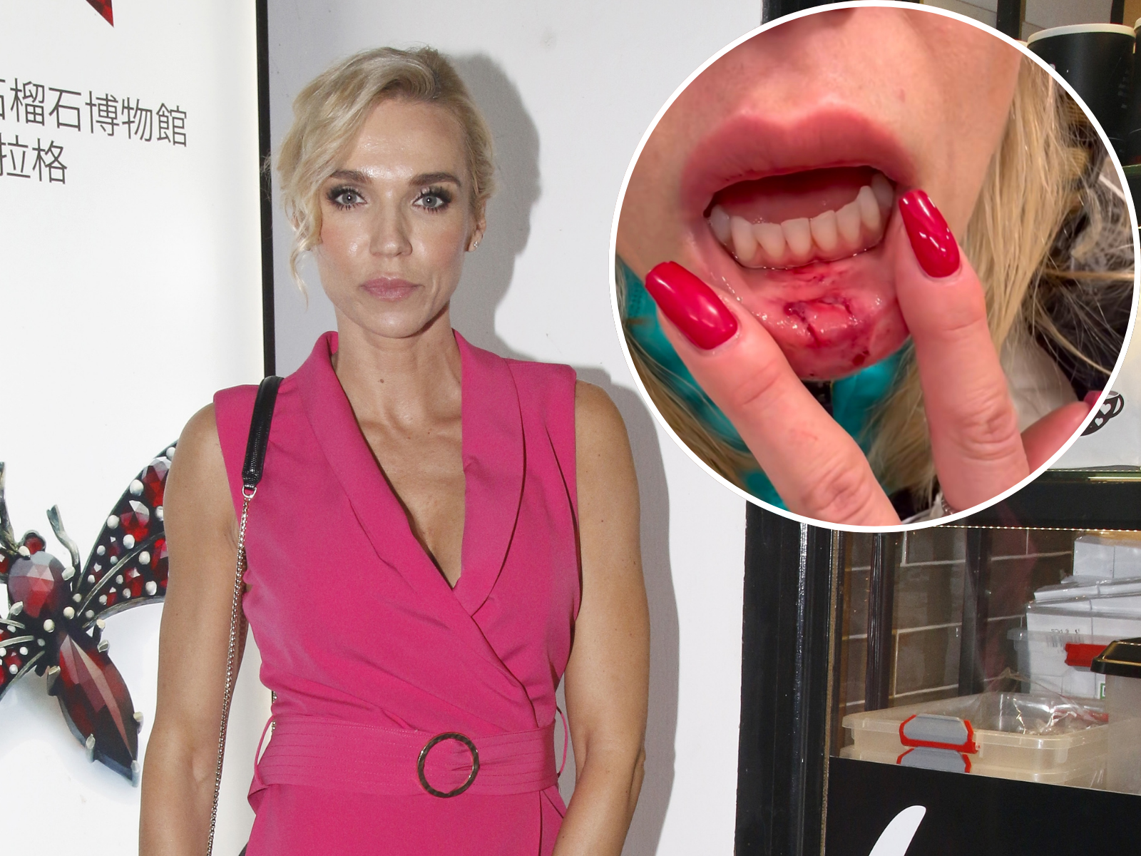 Hana Mašlíková vyděsila fanoušky. Krev a rozbitá pusa!