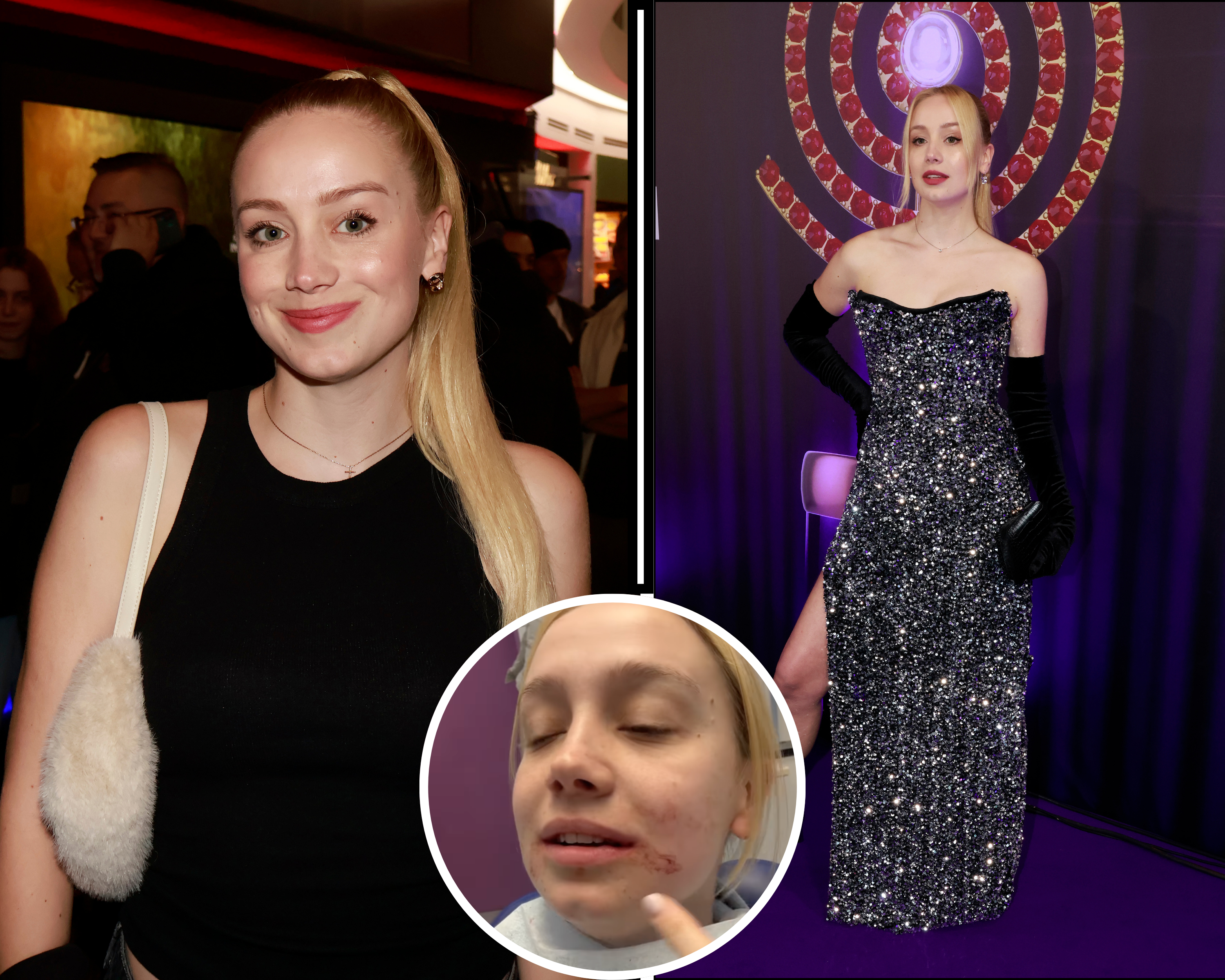 Anna Kadeřávková vyděsila své fanoušky. Je celá od krve a nemůže mluvit