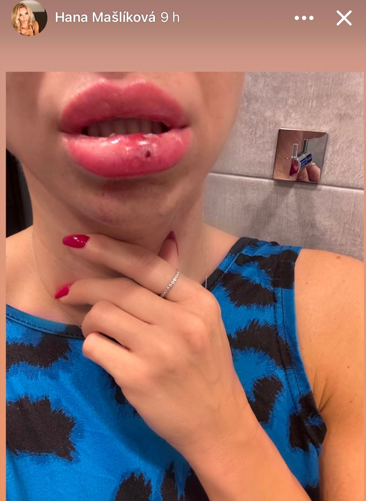 Hana Mašlíková vyděsila fanoušky fotkou.