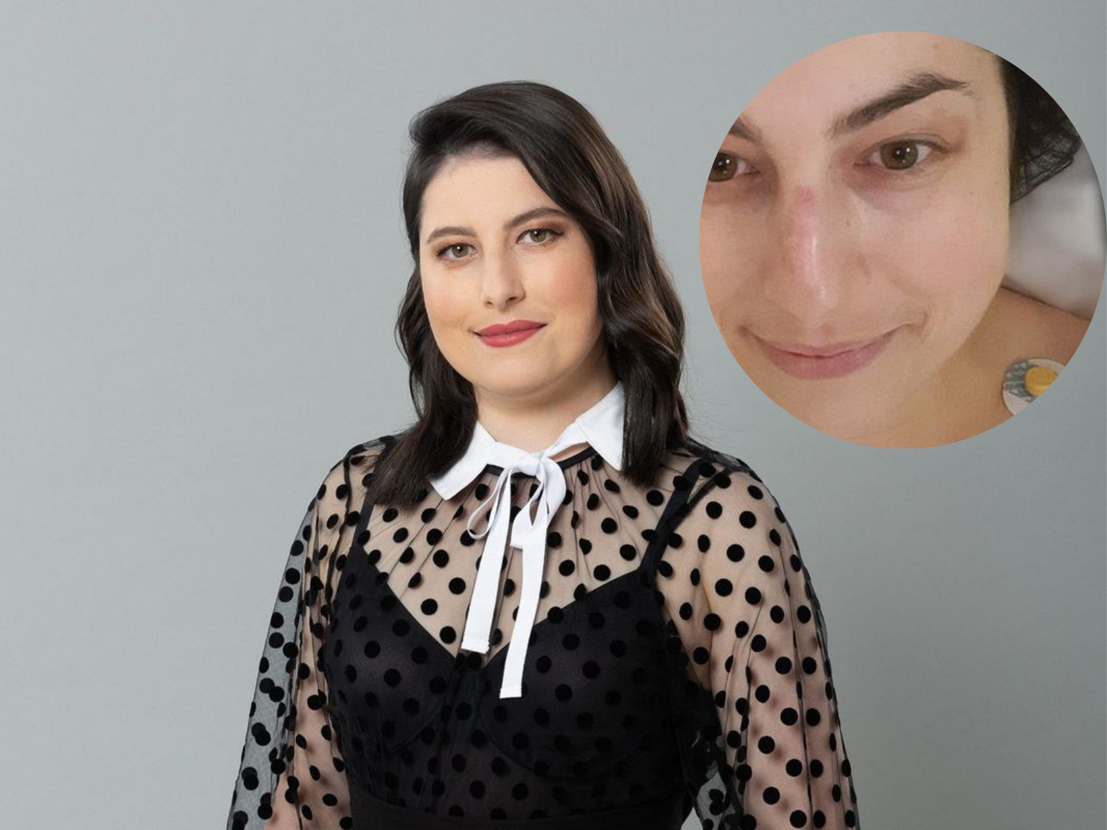 Nechybělo málo a zemřela by: Belladona z pořadu Na Lovu má dodnes trauma